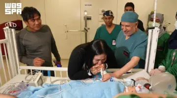 في إنجاز طبي جديد.. نجاح عملية فصل التوأم الملتصق الفلبيني (أوليفيا وجيانا) بعد 6 ساعات